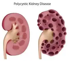 maine-coon-kidney-with-pkd